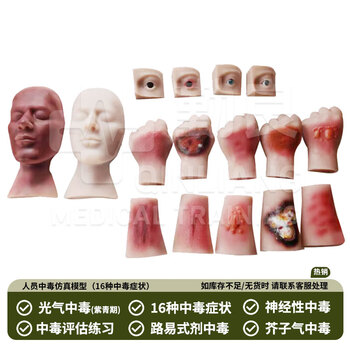 勤良伤情呈现训练模拟器材 人员中毒仿真模型 路易士气 芥子气 中毒模型 卫勤训练器材QL/C016