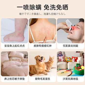 满婷(MANTING)除螨喷液220ml床上除螨喷雾免洗 宠物猫狗防螨99%除螨虫 满婷(MANTING)除螨喷液220ml床上除螨喷雾免洗 宠物猫狗防螨99%除螨虫