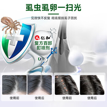 仁和百部酊虱子喷剂去阴虱一扫光男女专用儿童头发除虱卵虱立净100ml