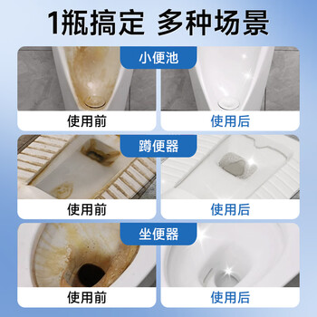巨奇严选尿碱溶解剂去尿碱强力去污除垢马桶清洁剂厕所祛黄洁厕灵500g 巨奇严选尿碱溶解剂去尿碱强力去污除垢马桶清洁剂厕所祛黄洁厕灵500g