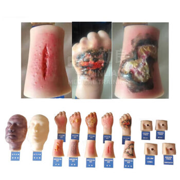 勤良伤情呈现训练模拟器材 人员中毒仿真模型 路易士气 芥子气 中毒模型 卫勤训练器材QL/C016