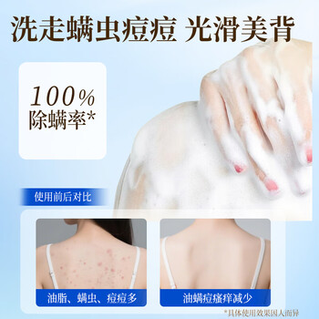 力仕康硫磺除螨沐浴露液体香皂清爽控油止痒洗头洗脸洗澡三合一男女专用 力仕康硫磺除螨沐浴露液体香皂清爽控油止痒洗头洗脸洗澡三合一男女专用