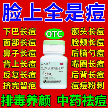 复方珍珠暗疮片脸上去痘痘的药祛痘药口服祛痘印红肿硬块脓包痘痘青春