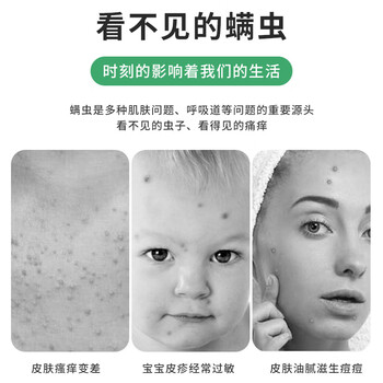 CHEIR 除螨包植物去除螨虫喷贴剂螨立净家用床上被子免洗除螨包10袋装