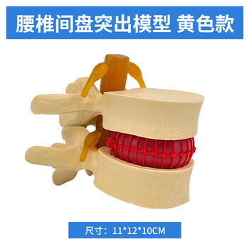 椎体模型品牌及商品- 京东
