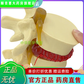 椎体模型品牌及商品- 京东 椎体模型品牌及商品- 京东