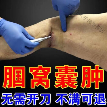 【最快三天】滑膜炎膕窩囊腫專用膝蓋積水積液軟組織損傷腿窩腫痛 30