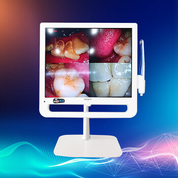 口腔内窥镜一体机索尼高清摄像头17寸wifi牙椅检测仪器牙科口扫仪1800