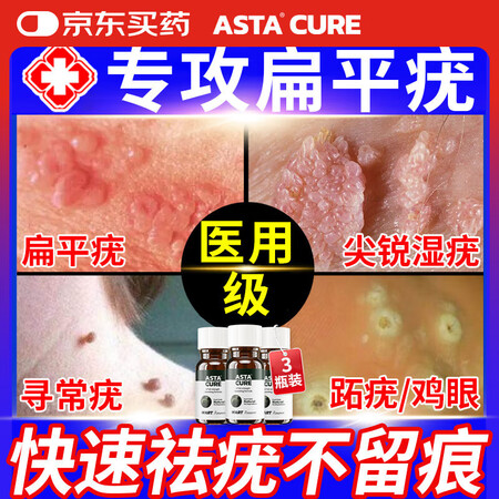 ASTACURE疣体脱落膏去疣膏旗舰店医用快速去疣体100%...