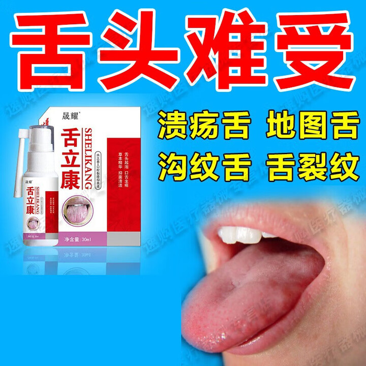 舌裂舌头裂纹干裂舌炎灼口综合征症口腔喷雾用药舌头上火有齿痕舌 单盒体验装【图片 价格 品牌 报价】-京东