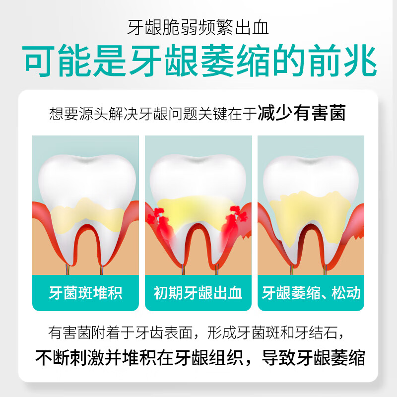 好易康（HAOYIKANG）生物溶菌酶 3号牙膏 改善牙龈出血问题 改善牙龈脆弱萎缩120g/支