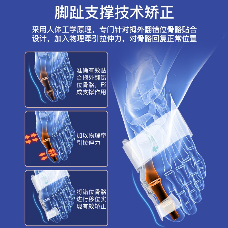 科靓 Techbeauty拇指外翻矫正器 拇指矫正器 足姆大脚骨脚趾矫正器 分趾垫分趾器拇指带男女士 日夜套装1对装