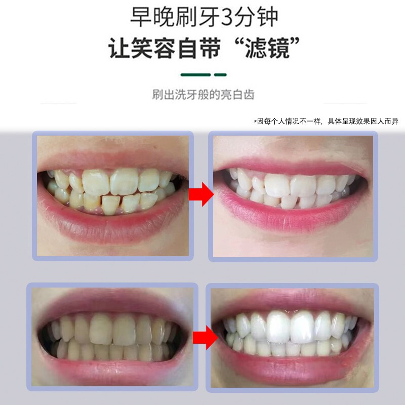 南京同仁堂小苏打牙膏美洁白牙齿益生菌抑菌淡黄去牙渍茶渍烟渍污垢牙斑护龈清新口气 180g