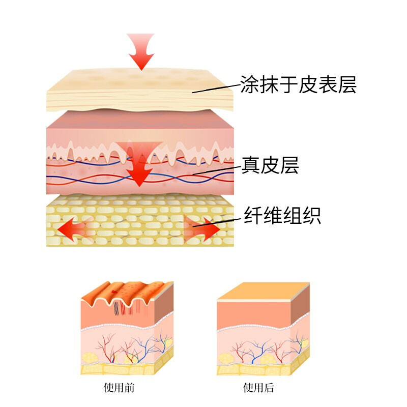 【购二发三】白云·山出品健医师去疤膏儿童祛疤膏成人疤痕灵巴克面部脸上摔伤烫伤刀疤手术辅助修复凝胶 1盒装