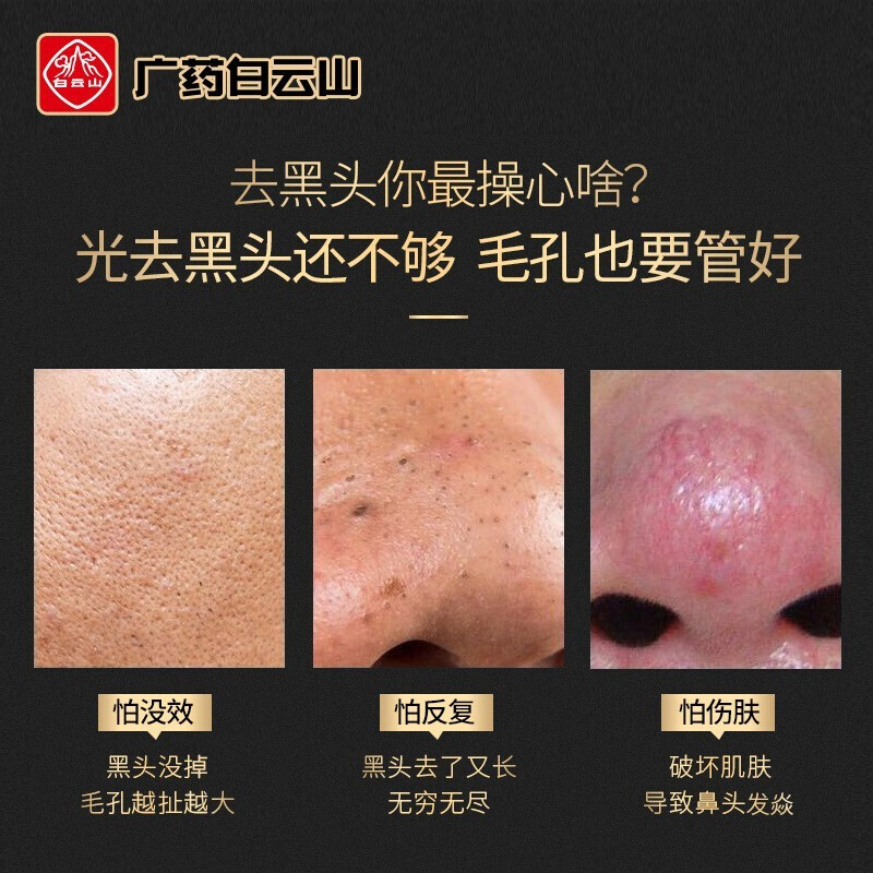 白云山去黑頭三部曲套裝吸附黑頭撕拉式面膜吸黑頭清潔收縮毛孔祛黑頭導(dǎo)出液鼻貼