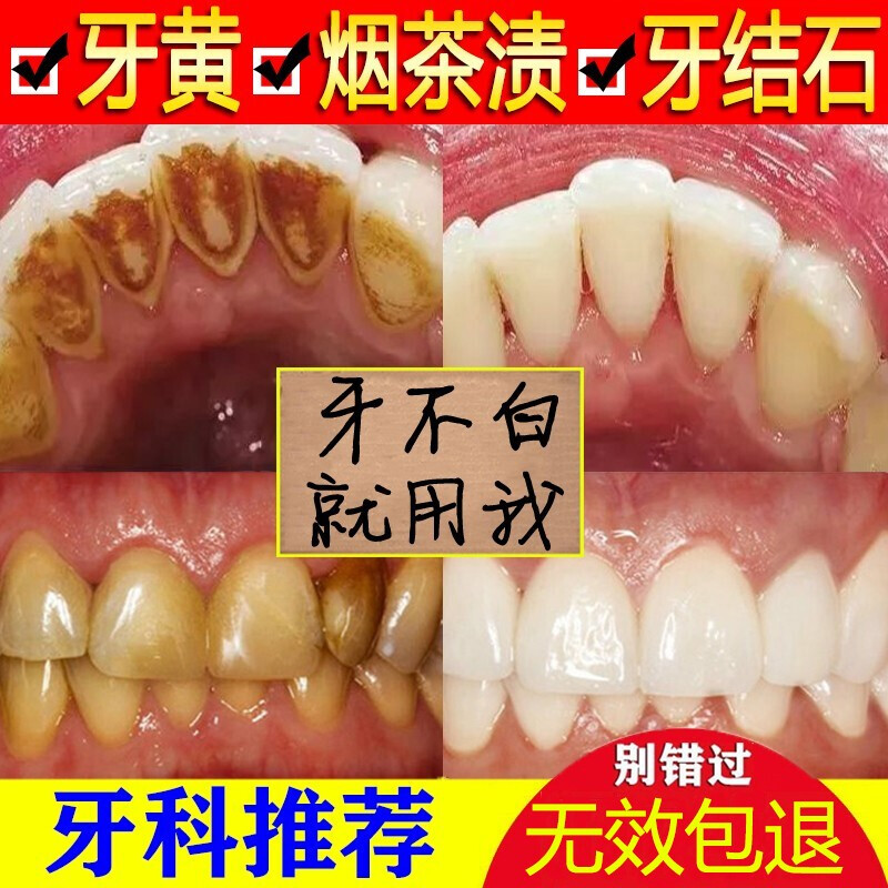 南京同仁堂 洁牙慕斯洁白牙齿牙膏清新口气去黄牙牙垢牙烟渍口腔护理泡沫百幽草 1瓶装=68【洁白牙齿】