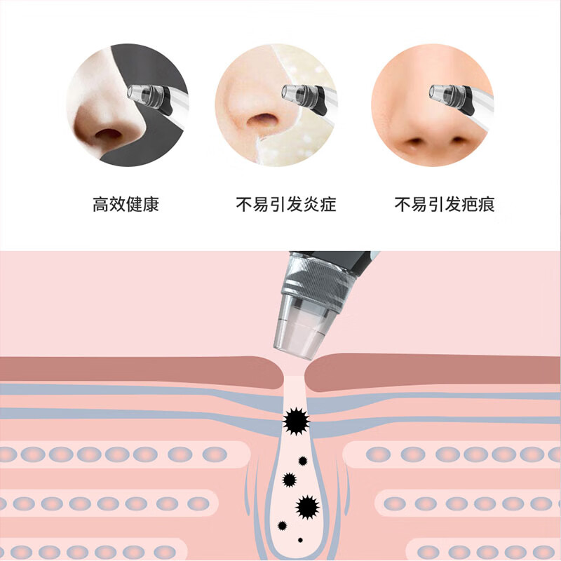 LINBOER吸黑头神器黑头吸出器去黑头粉刺仪器电动吸导出挤粉刺痘痘鼻子毛孔清洁器美容洁面洗脸仪 加热款黑头仪+导出液三件套+化妆棉