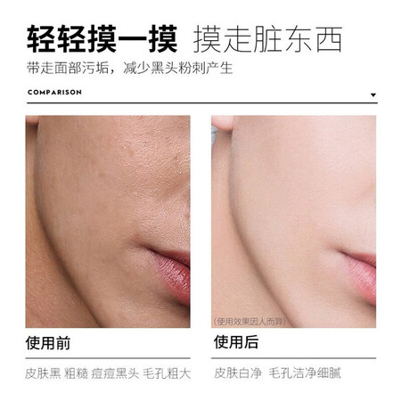 用过感受尊蓝 男士去角质慕斯祛死皮深层清洁毛孔脸部面部啫喱磨性价比高吗？真的好吗透过本质看真实效果！