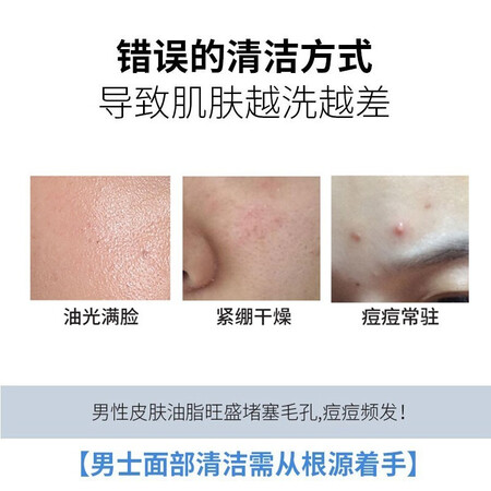 选择使用尊蓝 男士去角质慕斯祛死皮深层清洁毛孔脸部面部啫喱磨用起来靠谱吗？全新优缺点探讨评测！