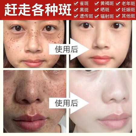 口碑剖析白云山星群【北京同仁堂】面膜美白祛斑补水面膜淡化斑祛评测划算不划算？用了三个月心得分享！
