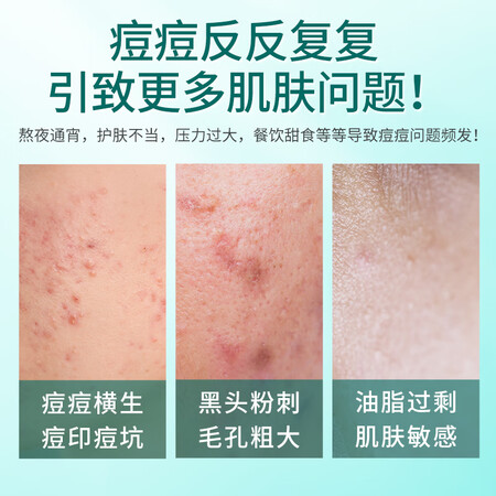 评测感受体验同仁堂苦参祛痘膏25g有谁用过没有？大神是怎么说的！