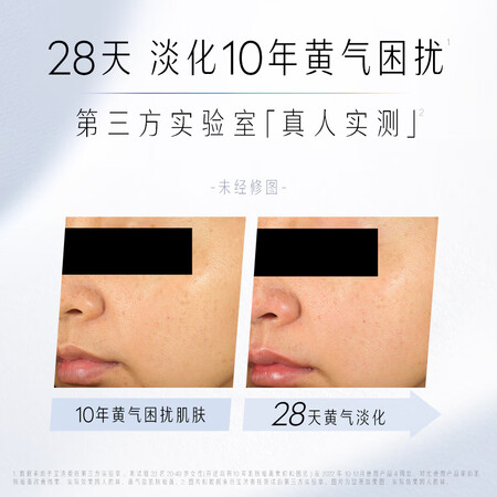 使用心得感受玉兰油（OLAY）抗糖小白瓶精华液+面霜护肤品套装生日礼好不好呀？老司机揭秘解说！