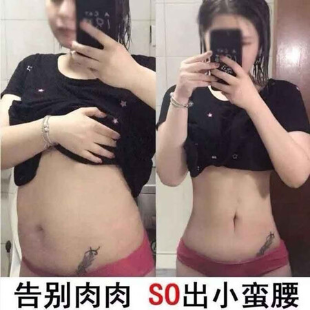 使用真实分享医后瘦肚身精油减身肥按摩霜纤体塑形提拉紧致 5盒装【买3送2，严重肥胖者如何怎么样？真实感受咋样！