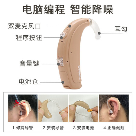 峰力q15sp和up哪个好?有什么区别?
