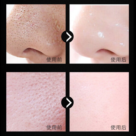 分享说说倩滋吸黑头面膜60g使用评测真的好吗？使用一个月如何！