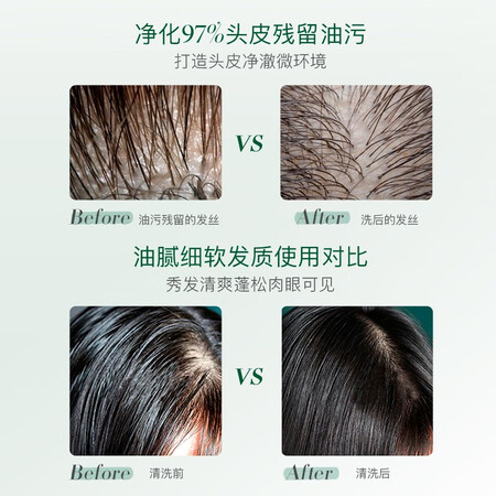 自身使用感受舒霖 控油洗发水无硅油蓬松头发洗头膏洗发液清爽去油氨口碑评价行不行？使用三个月经验分享！