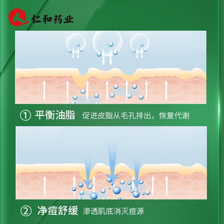 全方位曝光仁和祛痘膏痘肌痘坑痘疤痘痕粉刺修护芦荟胶匠心 男女士学生青春痘祛痘产品真的好吗？评测两周感受分享！