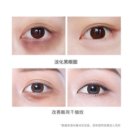开箱解密米雅诗海藻绿眼膜贴真实体验反馈？说说我的评价！！
