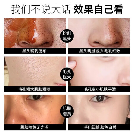 请教分析九叶草南京同仁堂黑头撕拉面膜去黑头粉刺收缩毛孔男女通评价真实好吗？心得你看下吧！