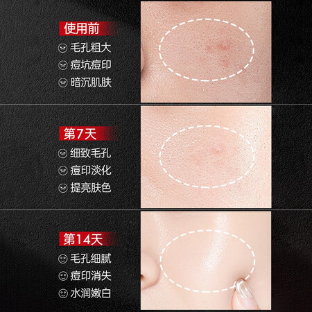 请问曝光步颜 男士左旋乳酸控油毛孔收缩精华液紧致肌肤毛孔粗大参数如何？1个月感受揭秘比较！