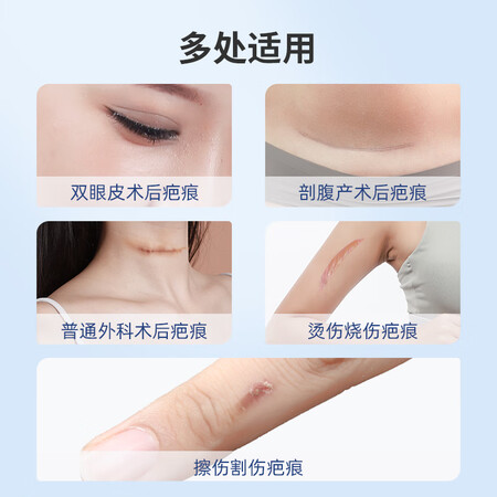 使用评测感受袋鼠医生20g支质量好吗？内幕剖析实情！！
