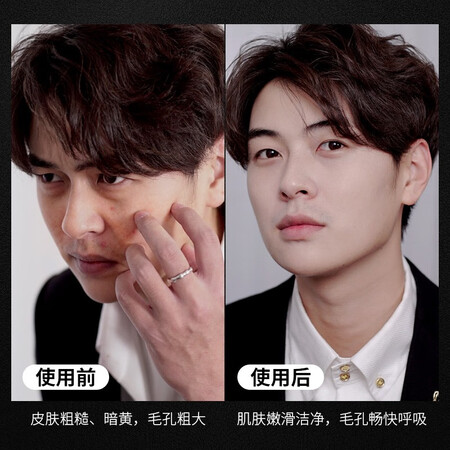 体验点评分析左颜右色 去角质男女士面部全身啫喱凝胶 温和深层清洁毛值不值得入手？交流三个月感受分享！