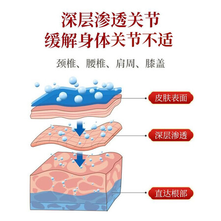 用户爆料【李时珍集团出品】芙顺堂活迈冷敷凝胶 颈肩腰膝哪难受抹哪 专为关节不适评价怎样？新手必看内情！