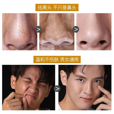 全新体验九叶草南京同仁堂黑头撕拉面膜去黑头粉刺收缩毛孔男女通真实感受质量？达人深度剖析！