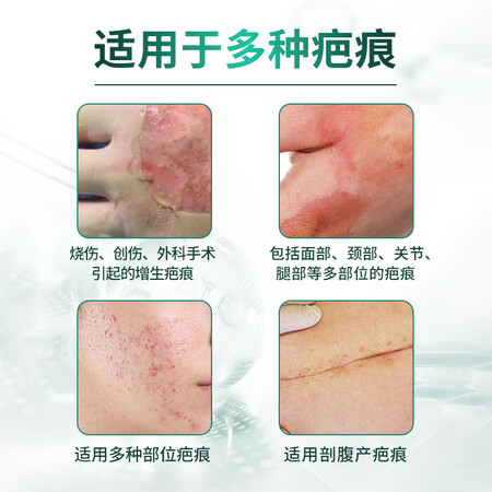 简单对比云南白药疤痕凝胶销量如何？亲们说说好不好！