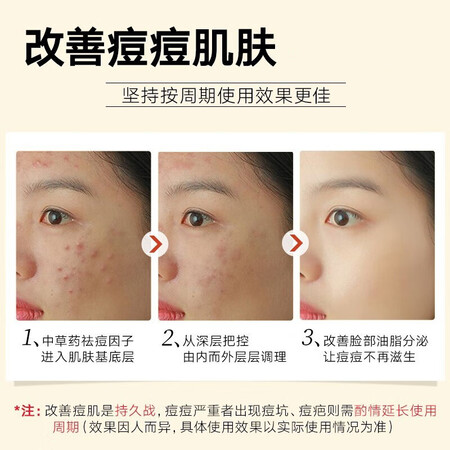 达人吐槽同仁堂控油祛痘膏草本淡痘印淡化痘坑痘疤保湿祛痘凝胶霜青春质量让人放心吗？探讨揭秘真实使用体验！