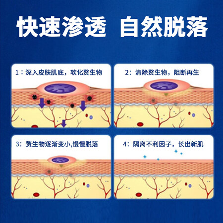 已经入手解密内廷上用北京同仁I堂鸡眼贴鸡眼膏去寻常根足部手部老茧肉刺脚是否值得入手？为你揭开神秘面纱！