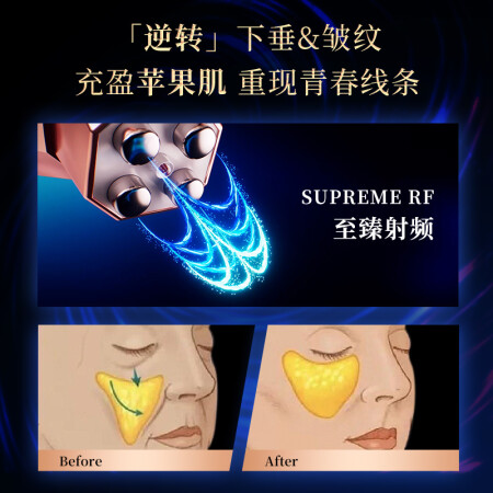 TriPollar初普奇迹美容仪用户体验怎么样_http://www.meifudie.com_好物_第2张