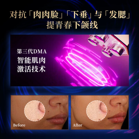 TriPollar初普奇迹美容仪用户体验怎么样_http://www.meifudie.com_好物_第4张