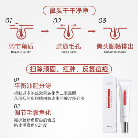 咨询了解质润壬二酸20%凝胶15g2祛痘膏去黑头闭口粉刺20%壬任二酸祛痘质量好吗？一味跟风还是真的好吗！