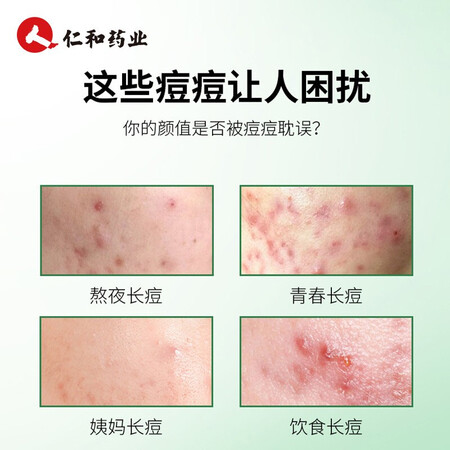 老司机点评仁和祛痘膏痘肌痘坑痘疤痘痕粉刺修护芦荟胶匠心 男女士学生青春痘祛痘产品质量怎么样？交流两星期心得分享！