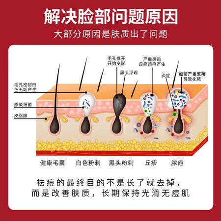真实解密芭莎叶壬二酸凝胶15%软膏祛痘精华凝露水杨酸唑去淡化黑头粉刺痘印乳膏 壬真实感受评测？避免上当赶紧看看！
