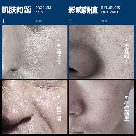 请教点评男士护肤品套装控油补水保湿改善黑头淡化痘印洗面奶爽肤水擦脸油乳液擦脸感觉真的好吗？看看一个月感受告知！