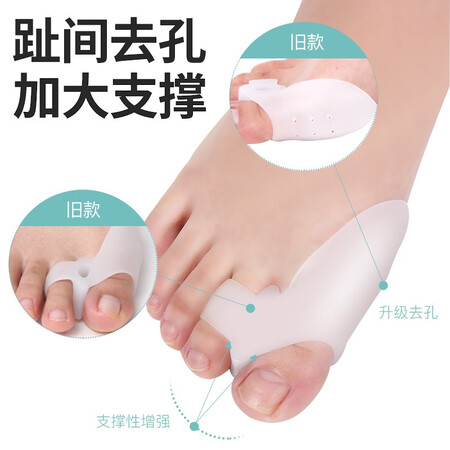 入手使用感受麦德威 医用拇外翻矫正器安全无毒 大脚趾大脚骨矫正器究竟好不好？优缺点都有哪些！