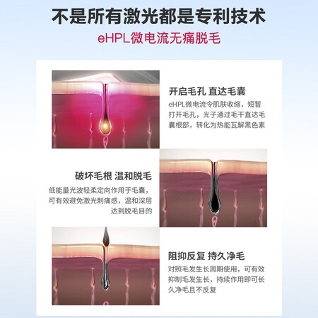 Silk'n infinty2.0怎么样？质量好不好？