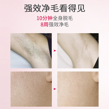 Silk’njewel脱毛仪怎么样-Silk’njewel脱毛仪性能表现如何_http://www.tuijianxing.com_好物_第2张